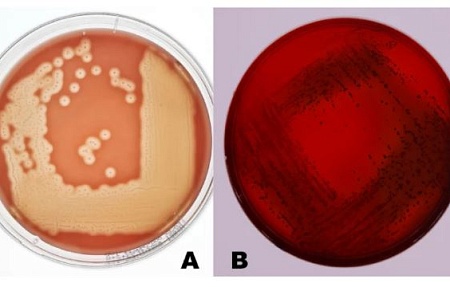 Молекулярные детерминанты патогенности штамма Streptococcus equi subsp. zooepidemicus, выделенного от дикого кабана в России