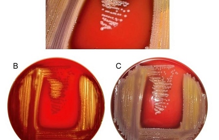 Large-scale genomic analysis of Elizabethkingia anophelis